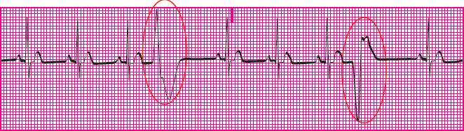 <p>Which rhythm is this?</p>