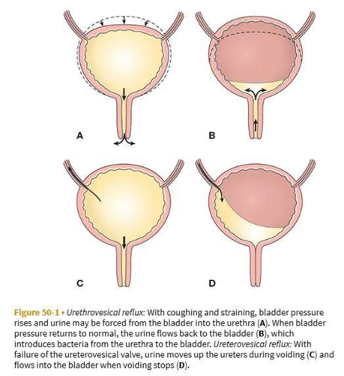 <p>Identifies obstruction or structural disorders of ureters and the renal pelvis.</p>