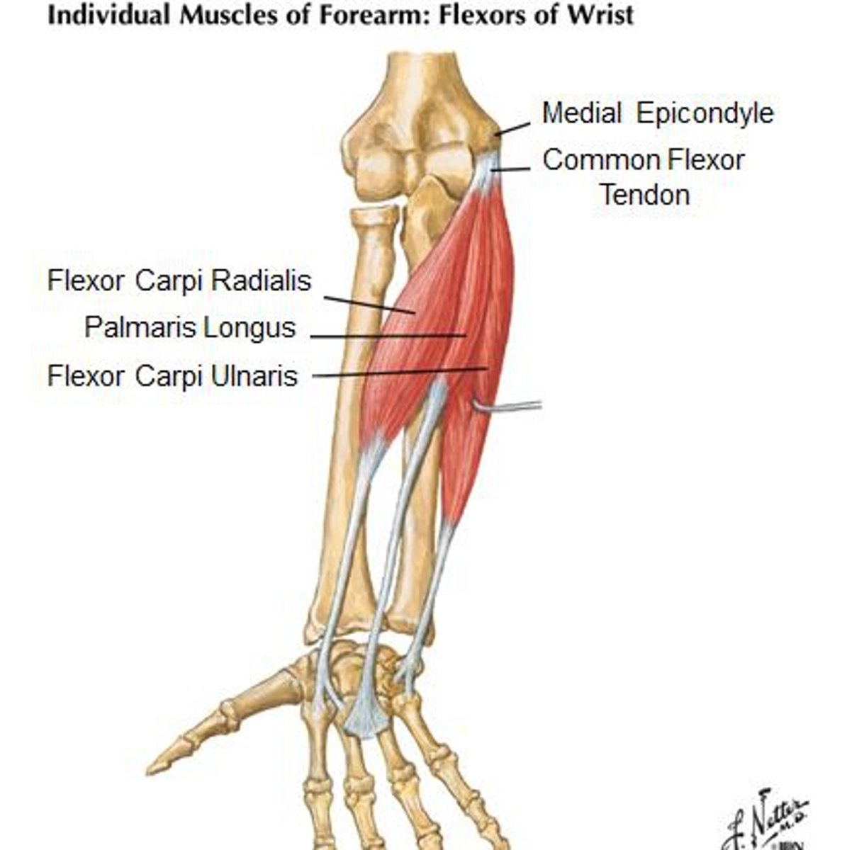 <p>Origin: medial epicondyle</p><p>Insertion: metacarpals, phalanges</p><p>Action: flex wrists, fingers, pronates forearm</p>