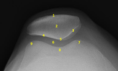 <p>2?</p>