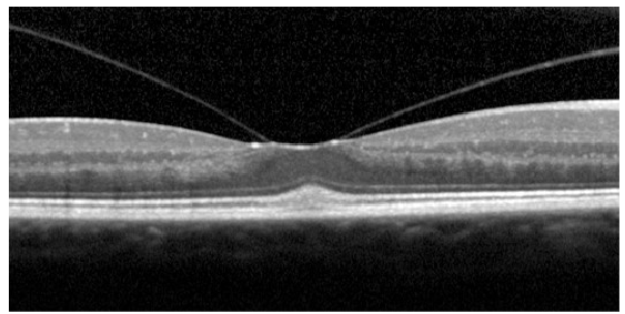 <p>Name the condition</p>