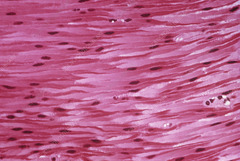<p>Muscle tissue. No striations, one nuclei per cell, cells taper and end to give "wavy" appearance</p>