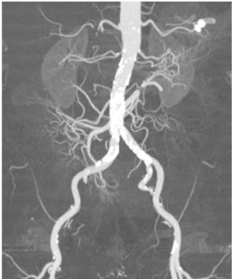 <p>what modality of angio?</p>