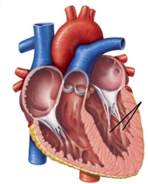 <p><span style="line-height: 17.375px;">Identify the structures&nbsp;</span></p>