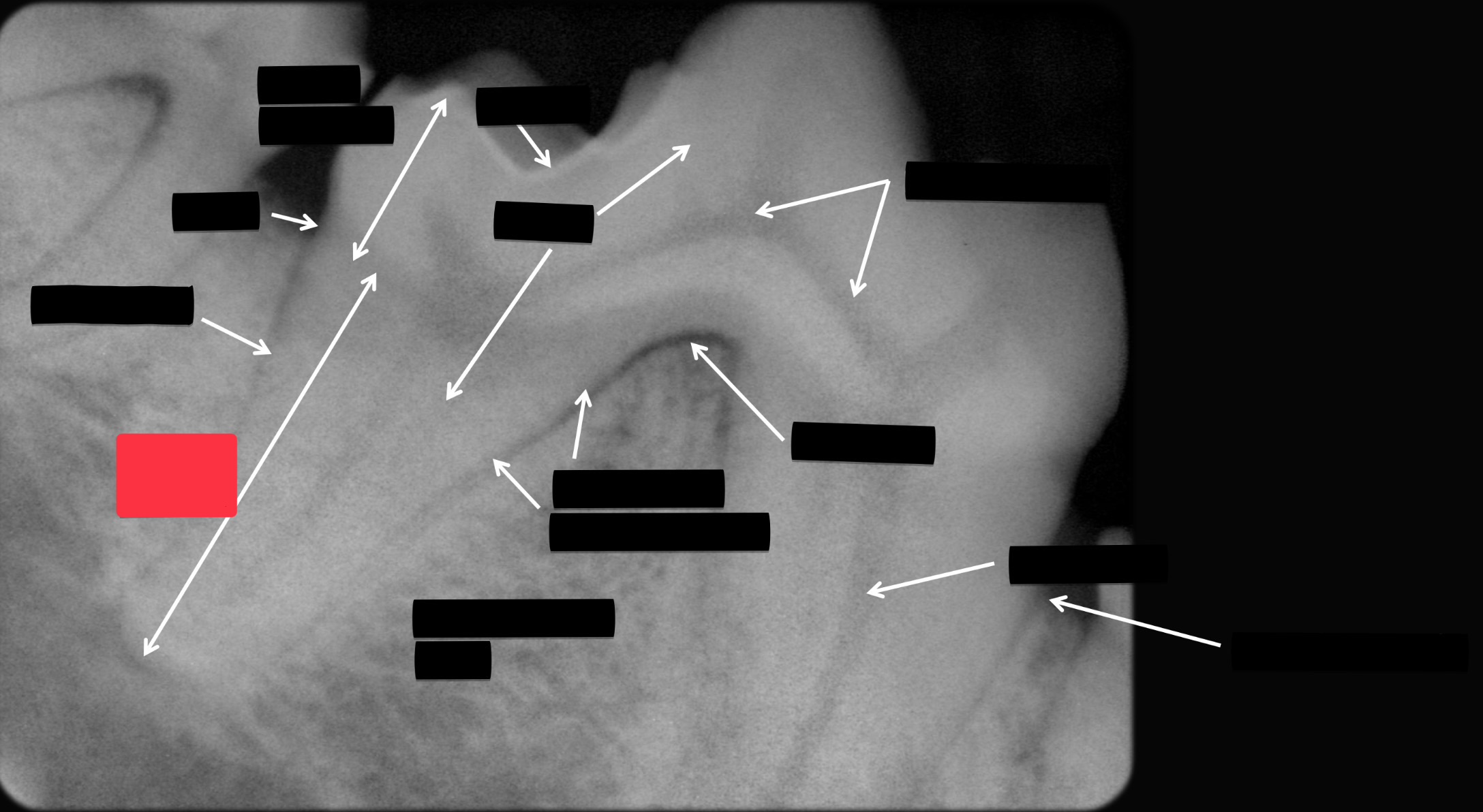 <p>Label this part of the tooth.</p>