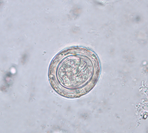 <ul><li><p>egg is 30-47 micrometers </p></li><li><p>grayish color </p></li><li><p>hollow lemon oncosphere </p></li><li><p>4-8 polar filaments outside oncosphere </p></li></ul><p></p>