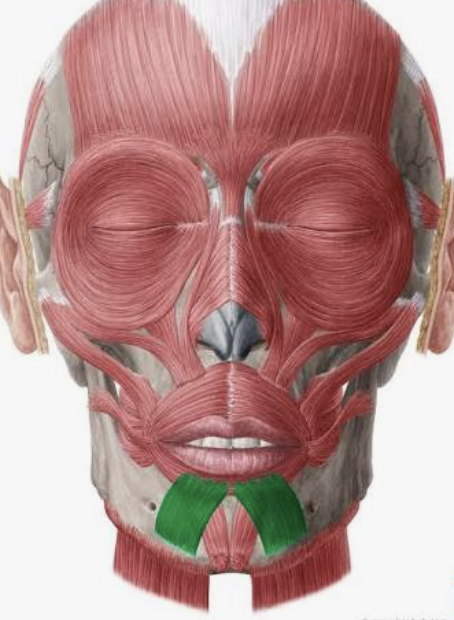 <p>Which muscle is this?</p>