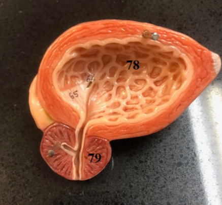 <p>What are the two structures in this picture?</p>
