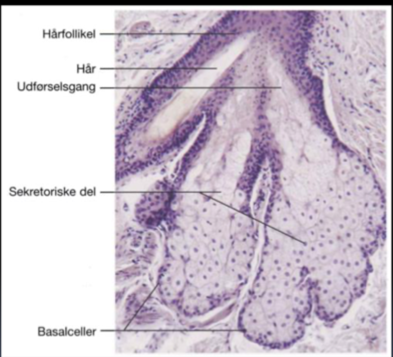 <p>Meget <strong>lipid</strong>.<br>(Talg + tilstopning/inflammation af hårfolliklen kan give acne)</p>