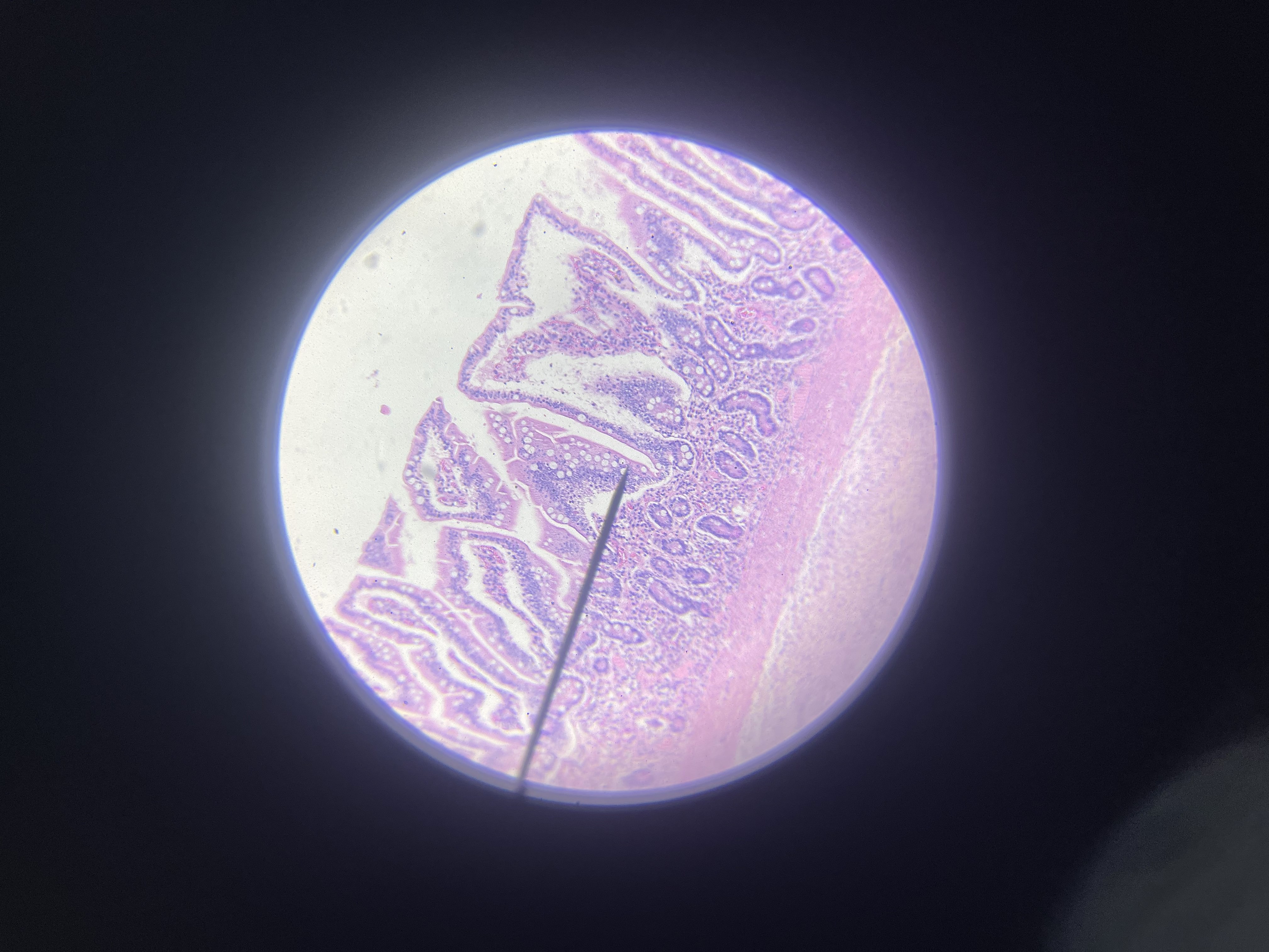 <p>What is the diagnosis?</p>