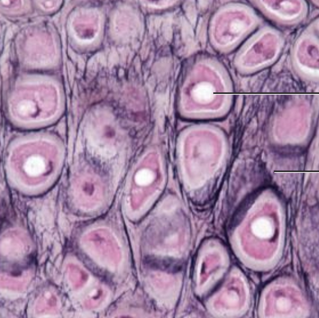 <p><span>Has more elastic fibers in the matrix; similar to hyaline cartilage</span></p>