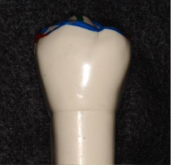 <p>Most premolar crown outlines narrow toward __________ so some proximal surfaces are visible.</p>