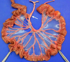 <p>the lesser (Mesenteric) and greater (antimesenteric) curvatures</p>