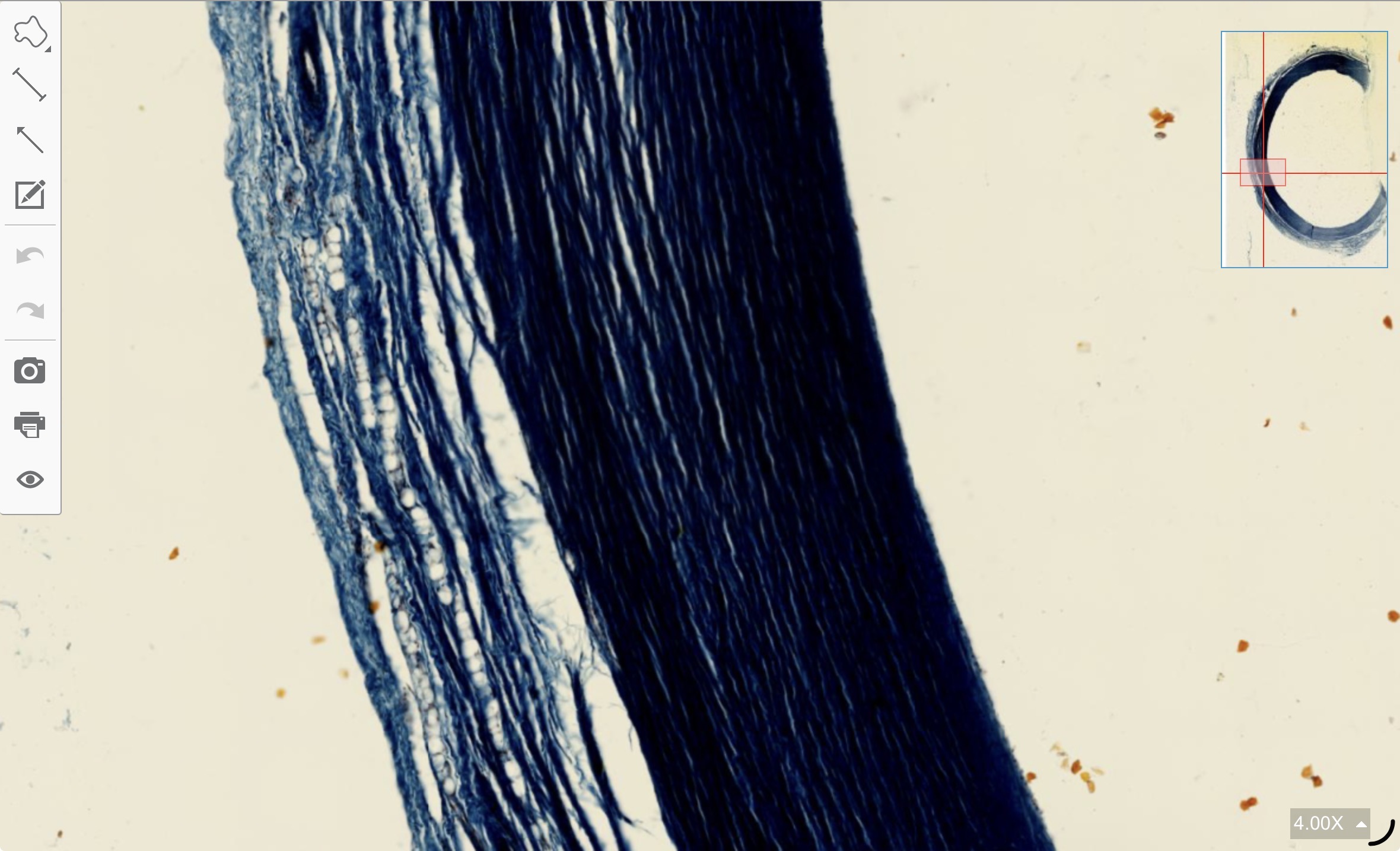 term image