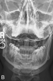 <p>AP Open Mouth: Is this Image Good?</p>