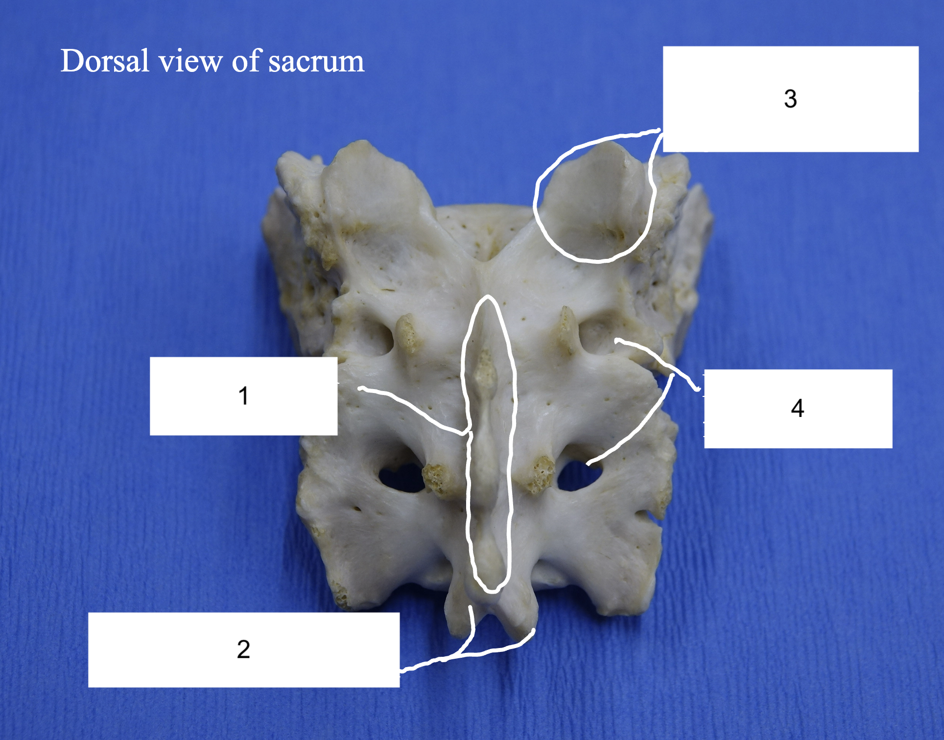<p>What is 3?</p>