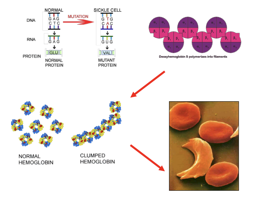 <p>Sickle cell anemia is a stark example of how even a SINGLE amino acid change can disrupt protein structure at every level, leading to severe disease. A <strong>point mutation </strong>in the beta-globin chain of hemoglobin replaces a <strong>hydrophilic glutamate with a HYDROPHOBIC valine</strong>. This primary structure alteration creates a <strong>sticky patch on the protein's surface</strong>. <strong>When deoxygenated, these altered hemoglobin molecules (secondary and tertiary changes) aggregate into long, rigid fibers. This abnormal quaternary structure polymerizes, deforming red blood cells into a sickle shape, causing blockages and oxygen deprivation</strong>!!</p><p>Clarifications: </p><p>Secondary and Tertiary Structure: Sticky Patch: In normal hemoglobin, glutamate sites on the protein’s surface, interacting comfortably with the watery environment of the red blood cell. However, because valine is hydrophobic, it seeks to AVOID water. This creates an abnormal <strong>sticky</strong>, hydrophobic patch on the surface of the hemoglobin molecule (Interesting??).</p><p>Quaternary Structure: Polymerization: When oxygen levels are low (deoxygenated state), <strong>these sticky patches on different hemoglobin molecules find each other and "lock" together to hide from the water.</strong> Instead of remaining as INDIVIDUAL, soluble tetramers (Normal Hemoglobin), the mutant molecules AGGREGATE into <strong>long, rigid polymers or fibers</strong> (Clumped Hemoglobin).</p><p>Cellular Impact: The Sickle Shape: These rigid fibers act like structural rods inside the red blood cell. They push against the cell membrane, distorting the normally flexible, disc-shaped cell into a RIGID <strong>crescent or "sickle" shape</strong>.</p><p>PHYSIOLOGICAL CONSEQUENCES: Unlike normal red blood cells, which are flexible enough to squeeze through the tiniest capillaries, sickle cells are stiff and brittle. <strong>Blockages:</strong> They get STUCK in small blood vessels (vaso-occlusion), blocking blood flow. <strong>Oxygen Deprivation:</strong> This leads to intense pain, organ damage, and anemia, as the sickle cells break down much faster than healthy cells. Clarification: Rapid breakdown of sickle cells = hemolysis. While a healthy red blood cell typically circulates for about 120 days, a sickle cell only survives 10 to 20 days (one reason is the hemoglobulin with sickle cells is chemically unstable [Hemoglobulin S]; it tends to break down and release free iron [heme] and reactive oxygen species inside the cell; this internal “chemical fire” further damages the cell’s internal machinery and membrane from the inside out). Because the bone marrow cannot keep up with the pace at which the cells are being destroyed, the body enters a state of <strong>chronic anemia</strong>. Symptoms include: <strong>Fatigue and Shortness of Breath:</strong> Due to fewer functional cells to carry oxygen.</p><p></p>