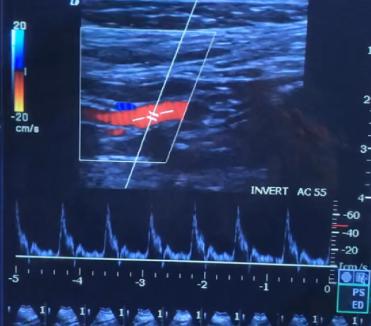 <p>Identify the vessel</p>