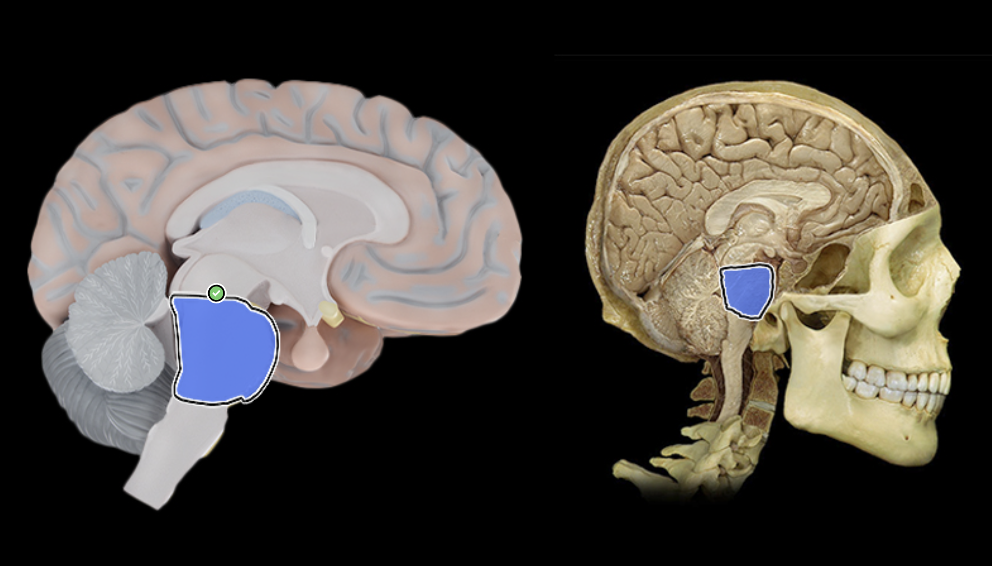 <p>What is labeled?</p>