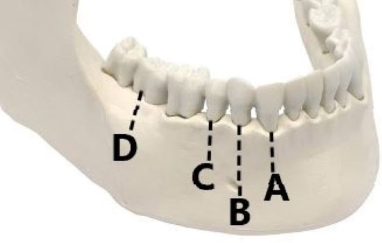 <p>A</p>