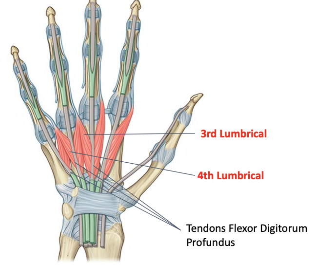 <p>Deep branch of ulnar nerve (C8-T1)<br>O: medial side of 2nd tendon and adjacent sides of 3rd, lateral side of 4th tendon of FDP<br>I: lateral sides of proximal phalanges and extensor hood of ring and little</p>