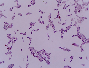 <p>PATHOGENIC BACTERIA:</p>
