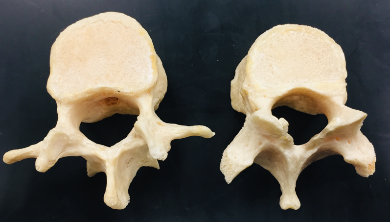 <p>structures of a vertebra</p>