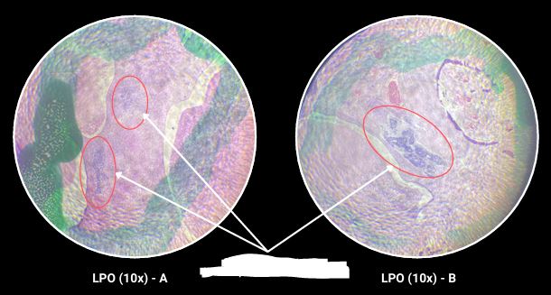 <p>What are the arrows pointing?</p>