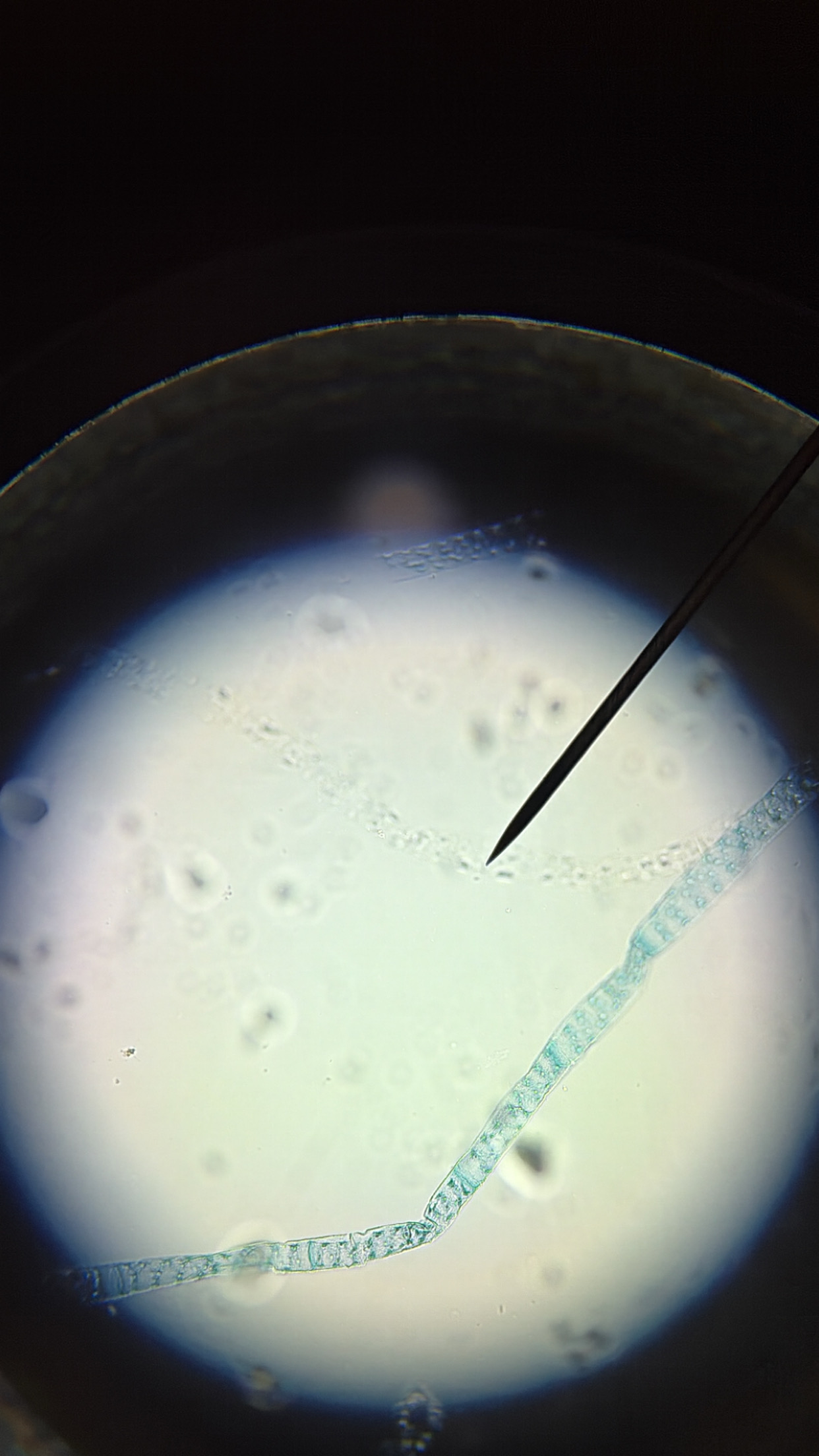 <ol><li><p>This slide shows a/an:</p></li></ol><p class="p1">a) Prokaryotic cell</p><p class="p1">b) Eukaryotic cell</p><p class="p1">c) None of the above</p><ol start="2"><li><p class="p1">Which type of cells does this slide show?</p><p class="p1">a) Cocci cells</p><p class="p1">b) Bacilli cells</p><p class="p1">c) Spirilli cells</p><p class="p1">d) None of the above</p></li></ol><ol start="3"><li><p class="p1">Which type of cell does this slide show an example of:</p></li></ol><p class="p1">a) Spirogyra</p><p class="p1">b) Volvox</p><p class="p1">c) Diatoms</p><p class="p1">d) None of the above</p><ol start="4"><li><p class="p1">Which type of cell does this slide show an example of:</p><p class="p1">a) Amoeba</p><p class="p1">b) Paramecium</p><p class="p1">c) None of the above</p></li><li><p class="p1">Which type of cell does this slide show an example of:</p><p class="p1">a) Archaebacteria or Eubacteria</p><p class="p1">b) Plantae</p><p class="p1">c) Protista</p><p class="p1">d) Fungi</p><p class="p1">e) Animalia</p></li></ol><p class="p1"></p><p class="p1"></p>