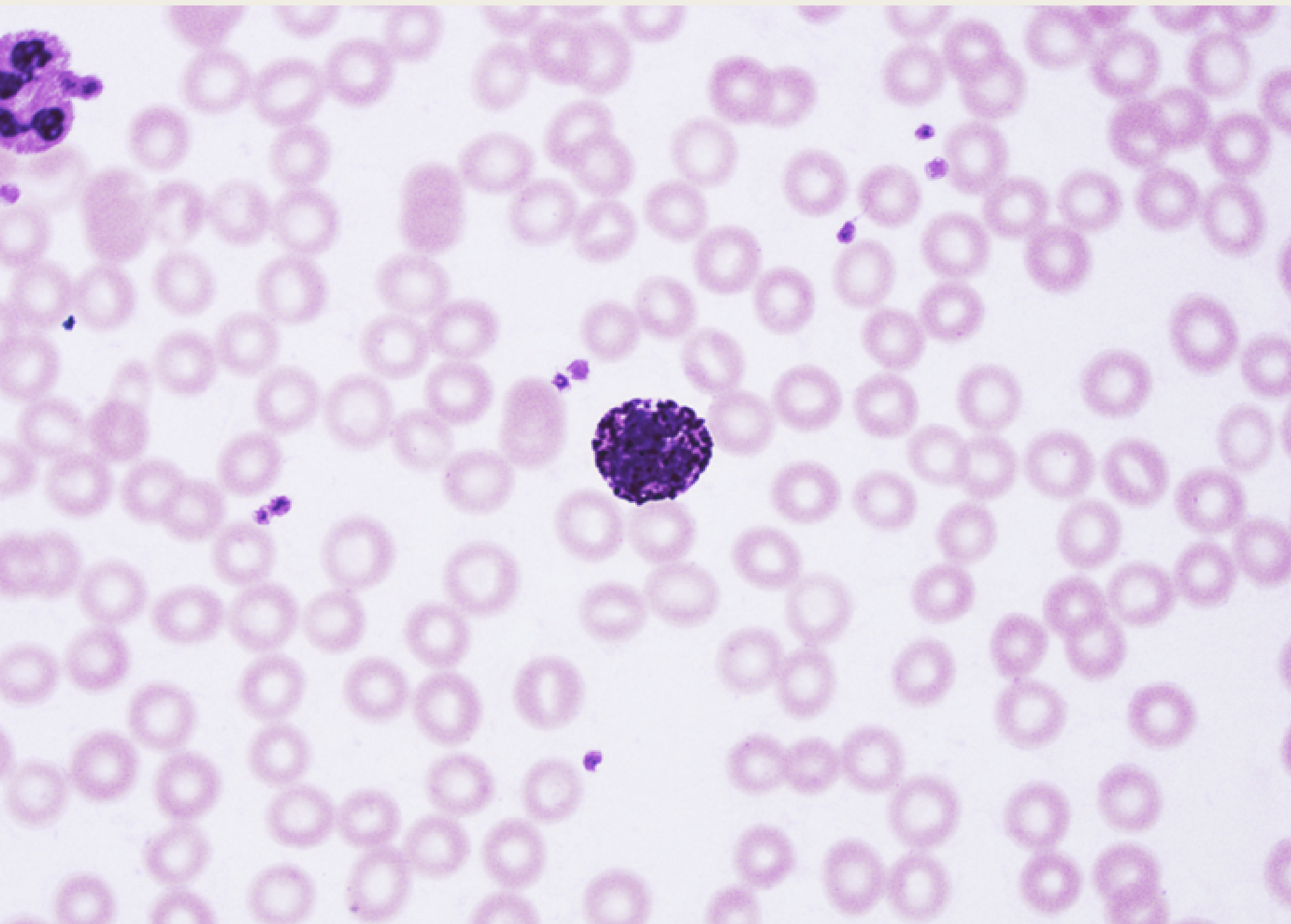 <p>Basophils</p><p>■ XX-shaped XX</p><p>(difficult to see due to</p><p>dark staining)</p><p>■ XX</p><p>■ Involved in XX</p><p>■ Prevents XX from</p><p>clotting too quickly</p><p></p>