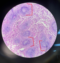 <p>Identify tissue (in red brackets)</p>