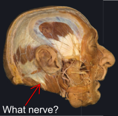 <p>Identify the structure</p>