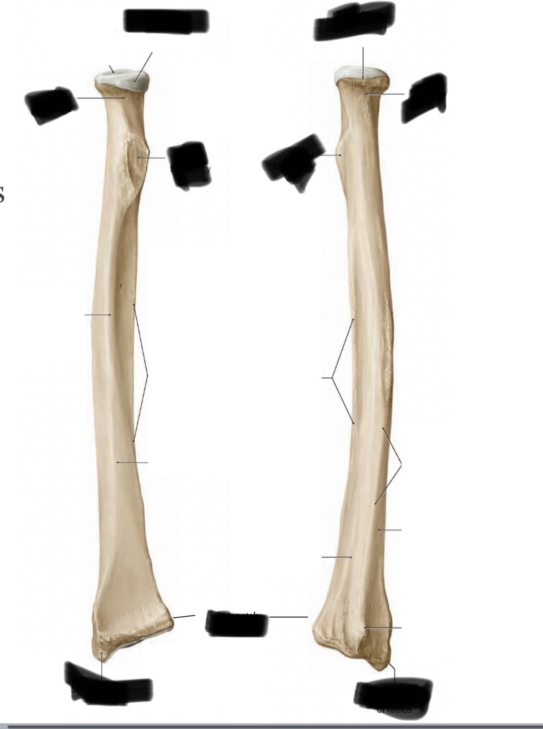 <p>name the parts of the bone and the bone</p>