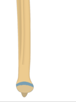 <p>What is this pointing to? What bone is it on?</p>