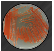 <p><span style="background-color: transparent;"><strong>What problem in streaking technique most likely produced the plate shown?&nbsp;</strong></span></p><p><span style="background-color: transparent;"><strong>Answer choices for all examples</strong></span></p><p><span style="background-color: transparent;">A. Failure to flame loop between sections</span></p><p><span style="background-color: transparent;">B. Crossing back into previous section on every streak</span></p><p><span style="background-color: transparent;">C. Forgetting to cross into first section on second streak</span></p><p><span style="background-color: transparent;">D. Forgetting to cross into second section on third streak</span></p><p><span style="background-color: transparent;">E. Not letting the loop cool before taking sample from tube </span></p><p><span style="background-color: transparent;">(Lecture #1-2 Questions)</span></p>