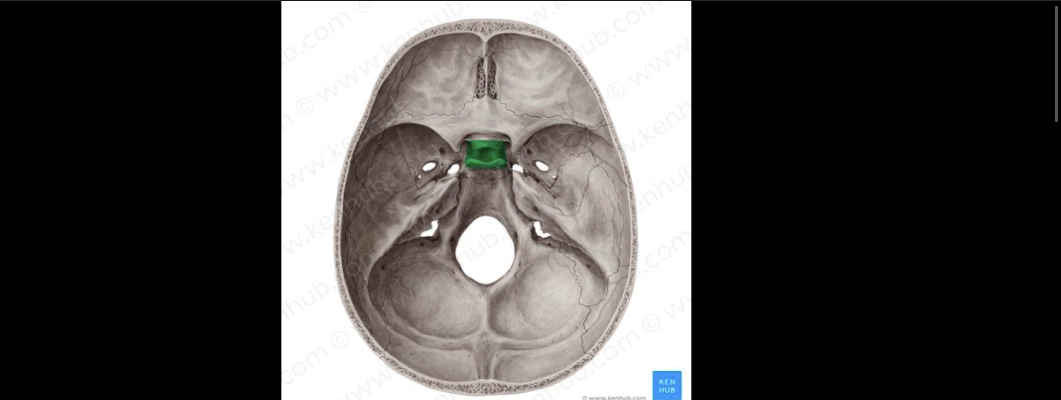 <p>Saddle shaped depression pituitary glad lies here</p>