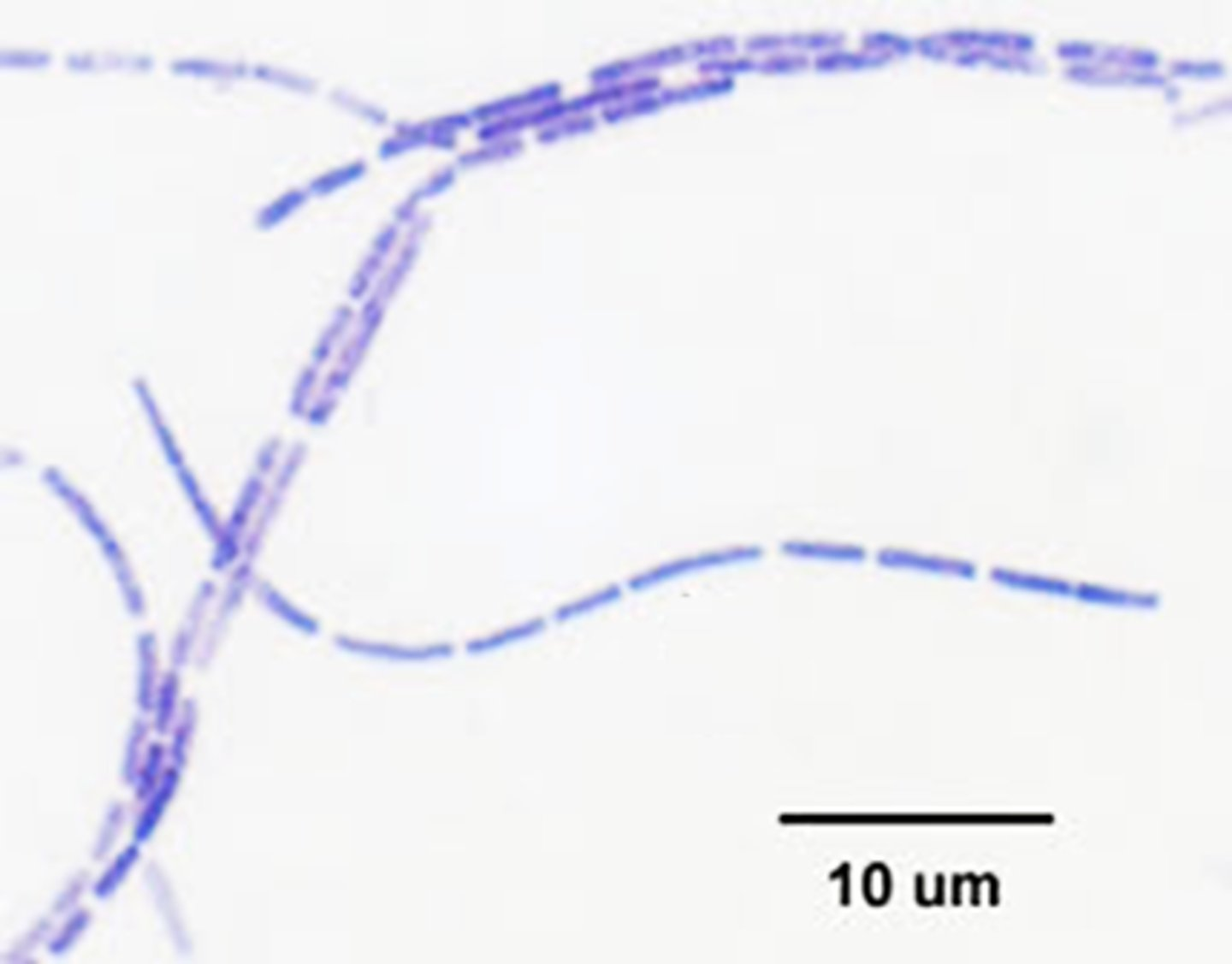 <p>The cellular morphology and arrangement of this bacterial species would best be described as</p><p>A. bacillus</p><p>B. streptococcus</p><p>C. tetrads</p><p>D. streptobacillus</p><p>E. Pleomorphic</p>
