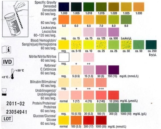 <p>urine composition - dipstick analysis</p>