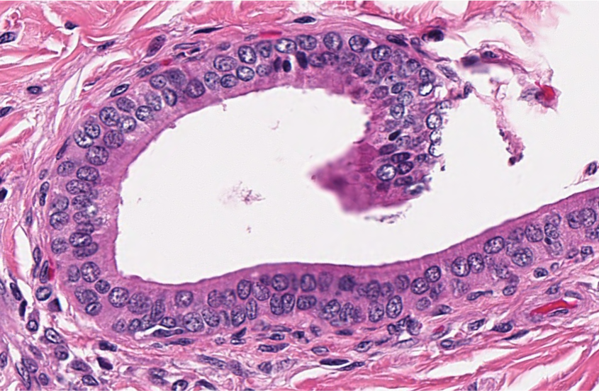<p><span style="font-family: "Calibri Light";">ID the type of epithelium lining the luminal surface of this duct.</span></p>