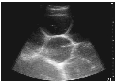 <p>Small intestinal Colic: D.X</p>