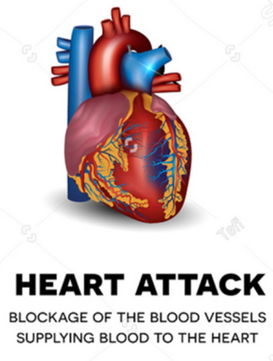<p>A) EKG (STEMI/NSTEMI), Troponin, CK-MB, Creatinine Kinase (CK), Myoglobin</p>