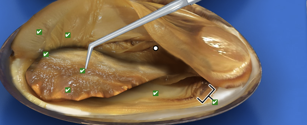 <p>What structure is this pointing to?</p>