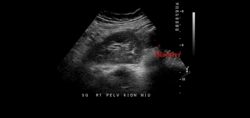 term image