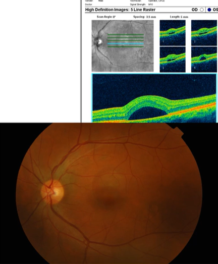 <p>Name the condition</p>