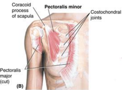 <p>Pectoralis Minor</p>