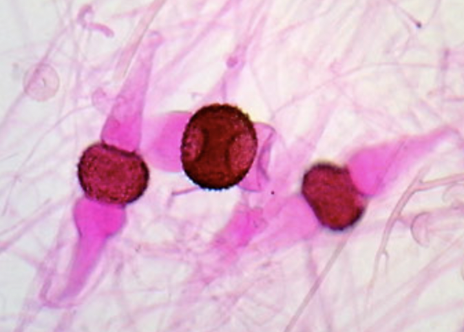 <ul><li><p>Two opposite mating types (+ and −) involved</p></li><li><p>Thick-walled, dark<strong> </strong>zygospore visible</p></li><li><p>Zygospore often rough/spiny in appearance</p></li><li><p>Suspended between two suspensor cells</p></li><li><p>Fusion region appears swollen compared to normal hyphae</p></li></ul><p></p>