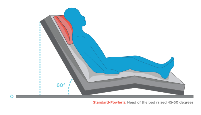 <p>Fowler's position</p>