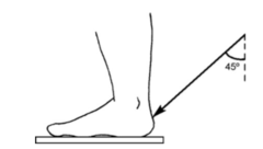<p>When performing an axial projection of the ankle, what should you see?</p>