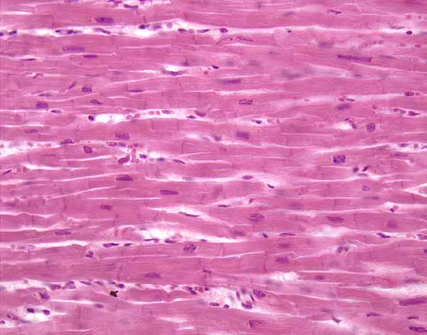 <p>Cardiac muscle tissue</p>