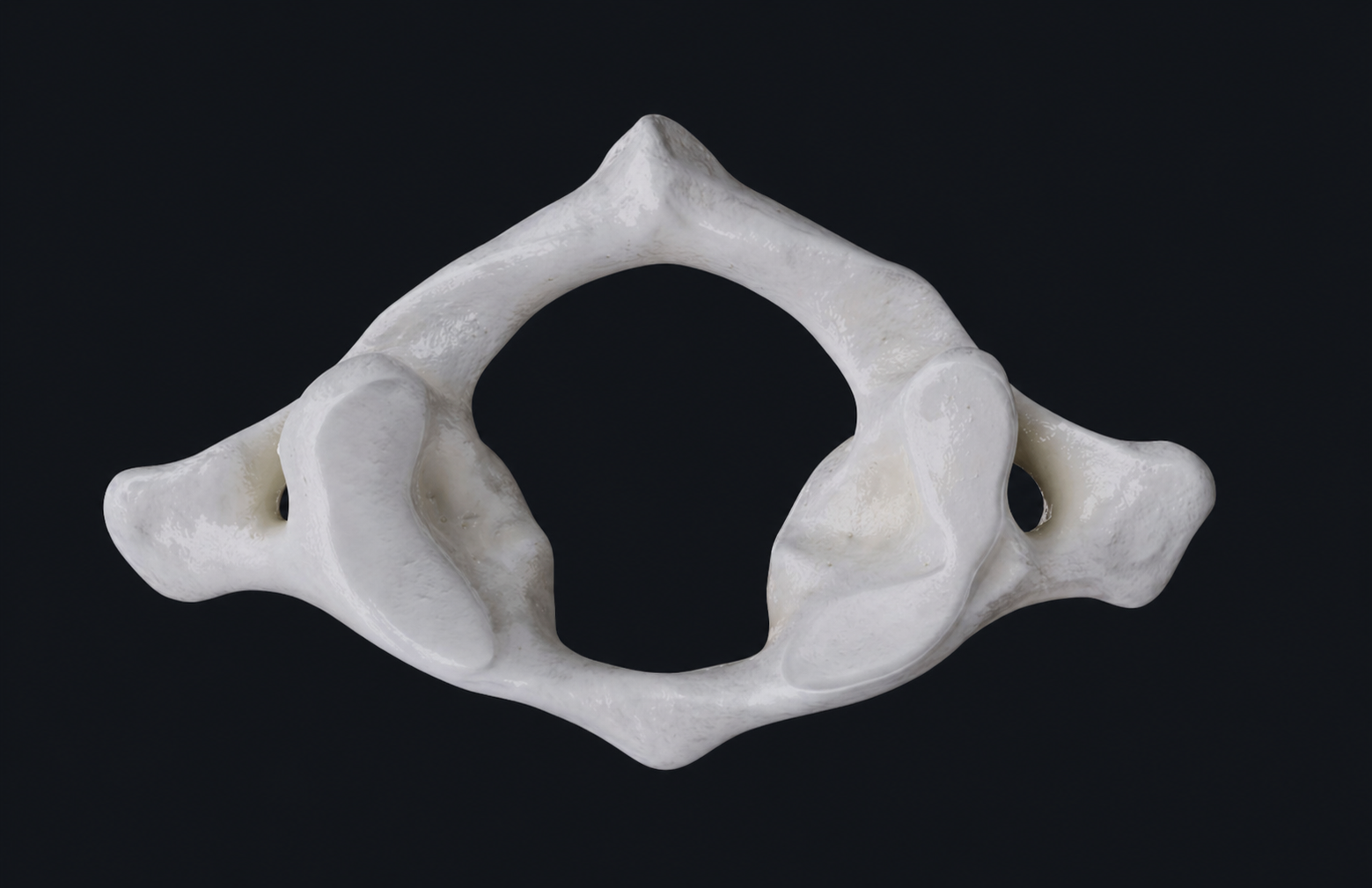 <p>Where is the anterior/posterior tubercle, what vertebrae only has this </p>